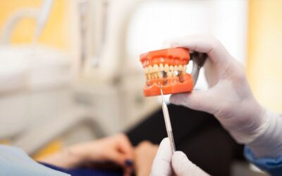 Do They Shave Down Your Tooth for a Crown? What Crown Preparation Involves