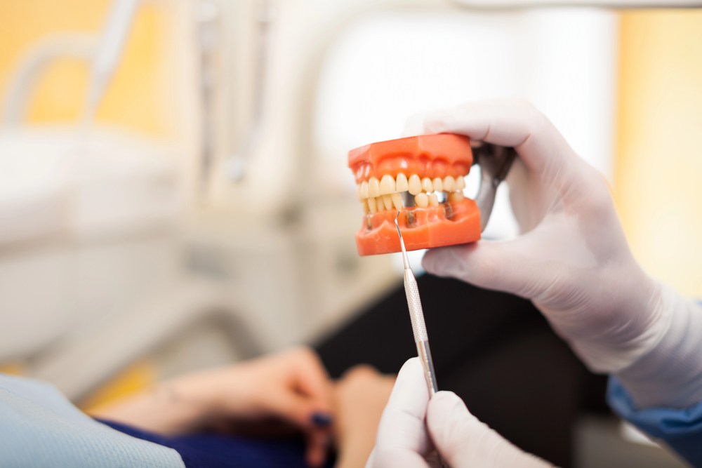 A hand points at a dental model in a dental office.
